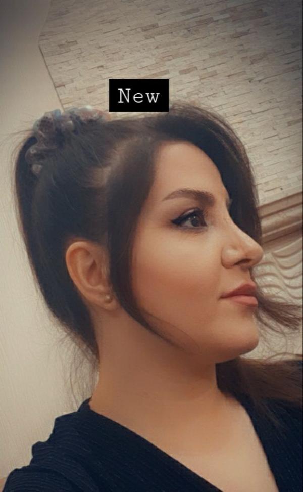 تصویر پروفایل نادره